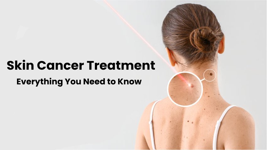 Skin Cancer Treatment in Pune Everything You Need to Know