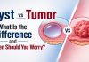 Medical infographic comparing Cyst vs Tumor — showing a fluid-filled cyst and a solid malignant tumor with the question when should you worry — by Dr. Pratik Patil, Cancer Specialist in Pune