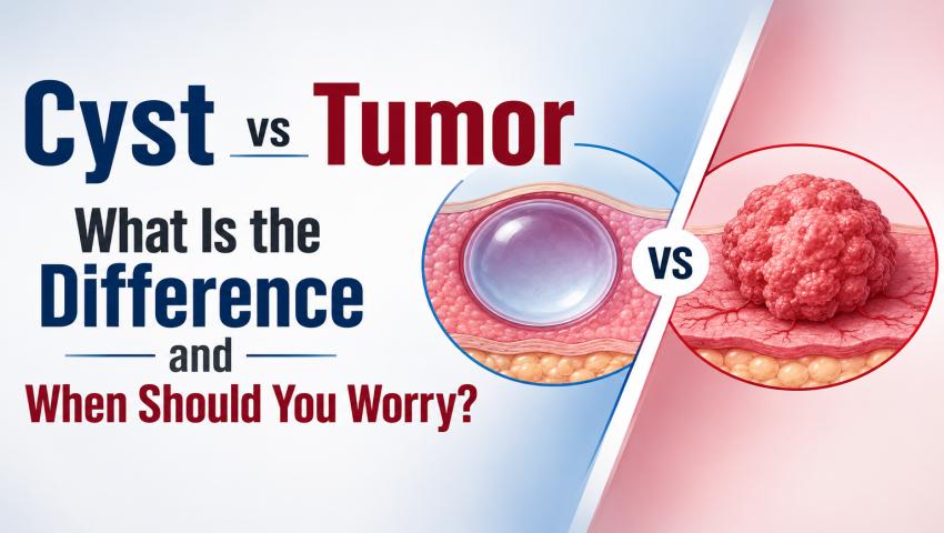 Cyst vs Tumor